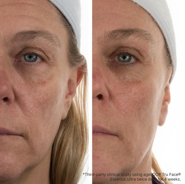 Nu Skin ageLOC® Tru Face® Essence Ultra, 60 cápsulas EUR - NewSkinShop