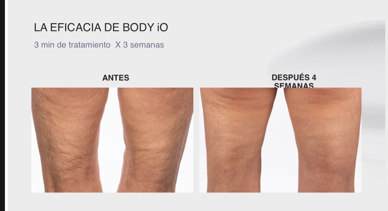 Nu Skin ageLOC® WellSpa iO™ Starter Kit AUS - NewSkinShop